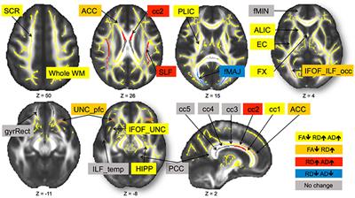 White Matter Integrity Declined Over 6-Months, but Dance Intervention Improved Integrity of the Fornix of Older Adults